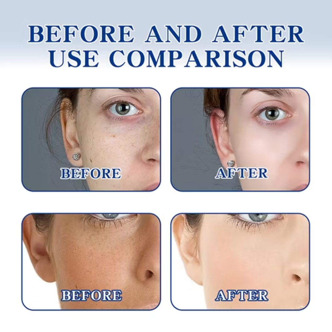 Chalonese Brightening Cream